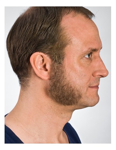 Patillas 9223 - KRYOLAN