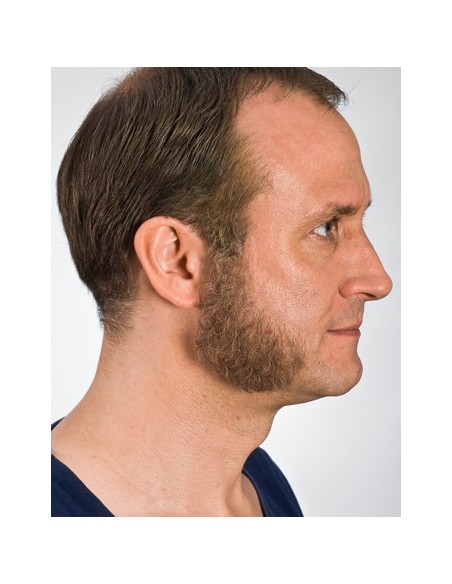 Patillas 9223 - KRYOLAN