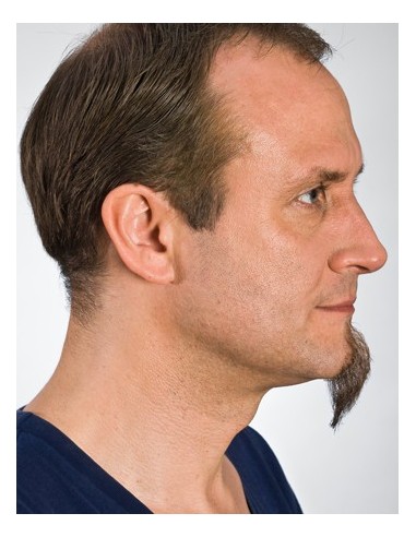 Perilla 9231 - KRYOLAN