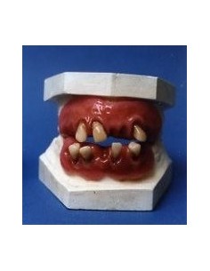 Dentadura deforme
