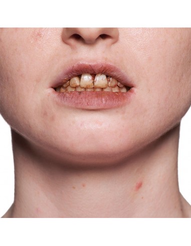 Esmalte Dental - KRYOLAN