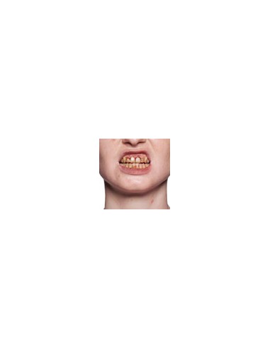 Esmalte Dental - KRYOLAN
