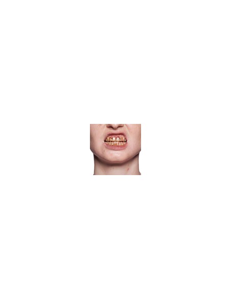Esmalte Dental - KRYOLAN